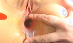 Deutsch Blone Babe 2 Doktor