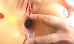 German Blone Babe Doktorspiele 2