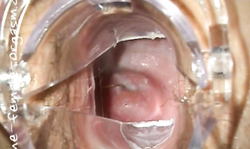 Speculum helps us to see the depth of her snatch